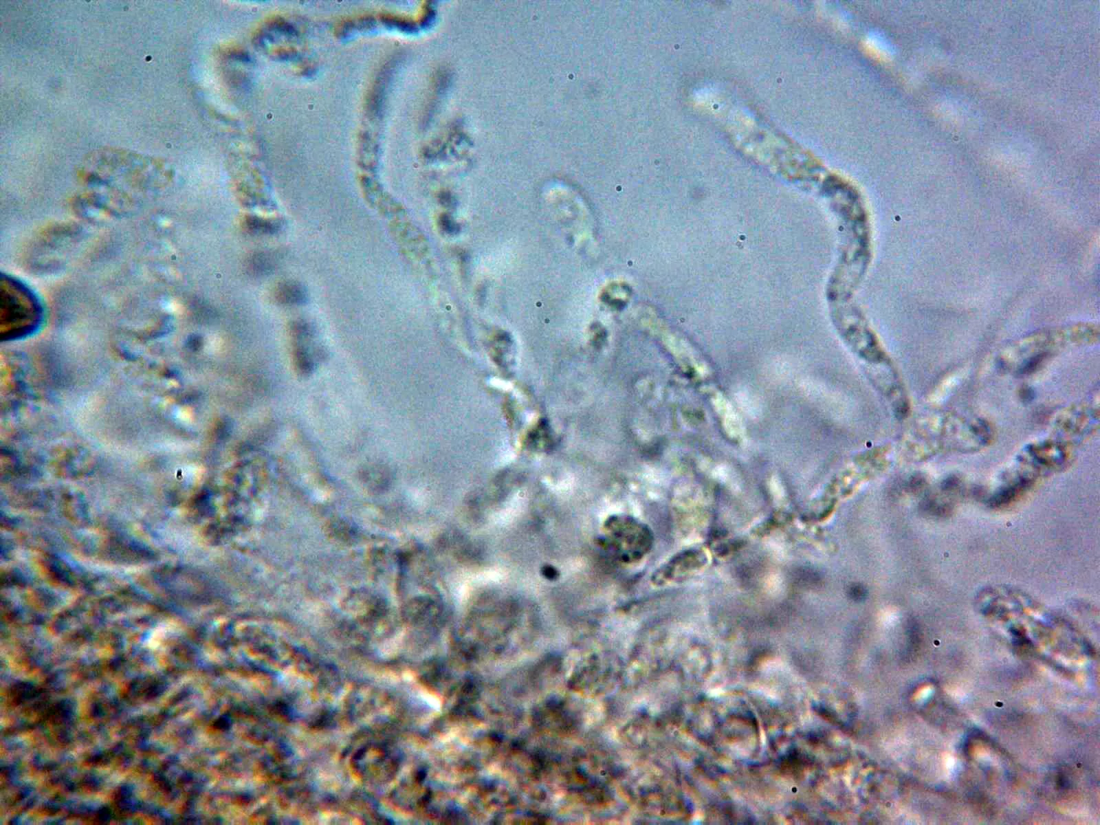 10 - Suprapellis agua 4